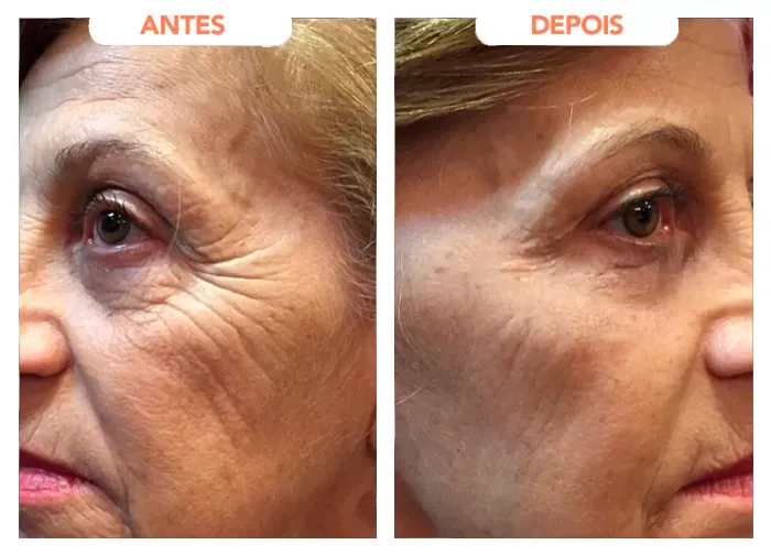 Depoimento de Zuleica Barbosa, 65 anos