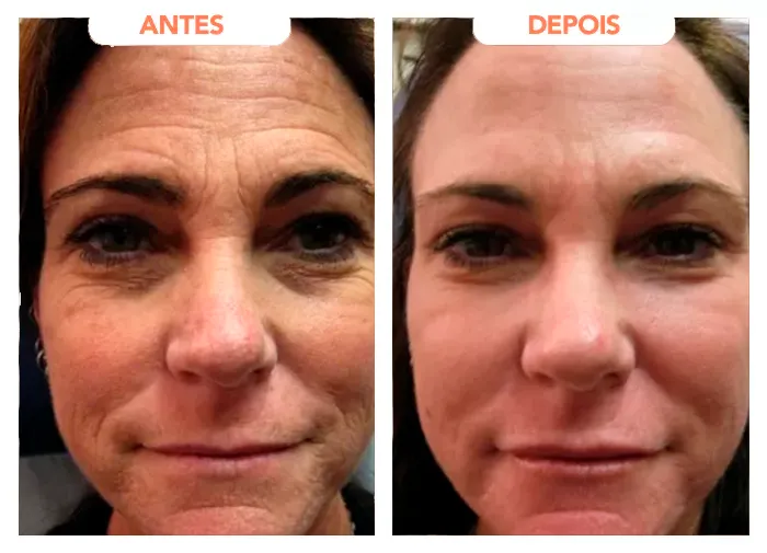 Depoimento de Juliana Silva, 49 anos