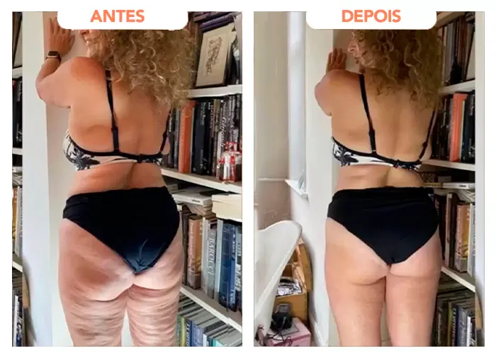 Depoimento de Marli Trentin, 51 anos